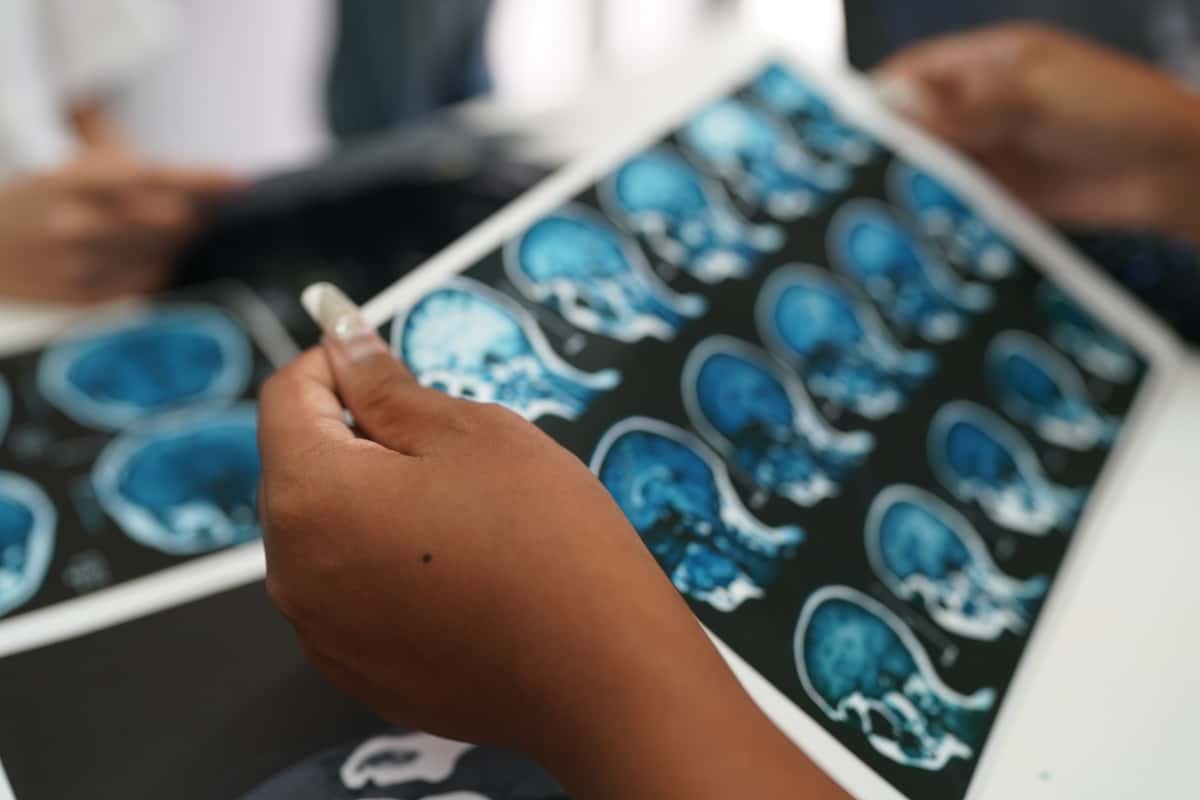 Photobiomodulation-cerebrale-traumatisme-cranien-commotion-vielight Photobiomodulation-cerebrale-traumatisme-cranien-commotion-vielight