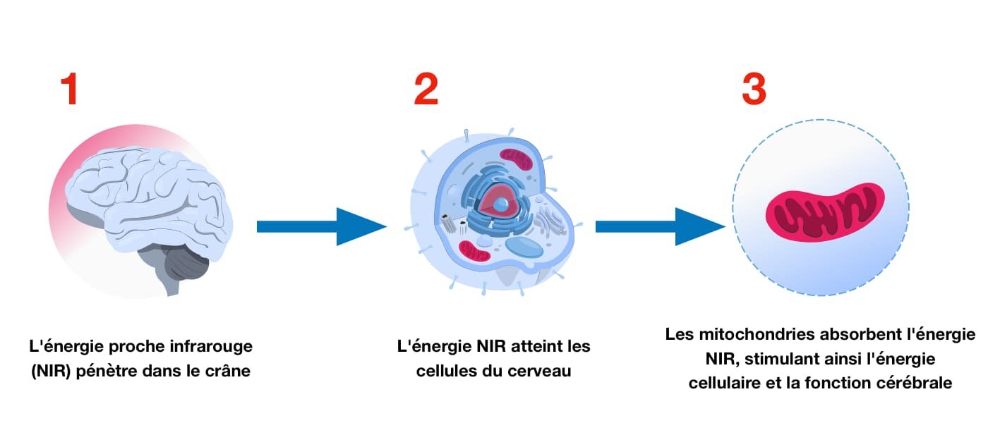 Photobiomodulation-et-effet-cellules-nerveuses1 Photobiomodulation-et-effet-cellules-nerveuses1