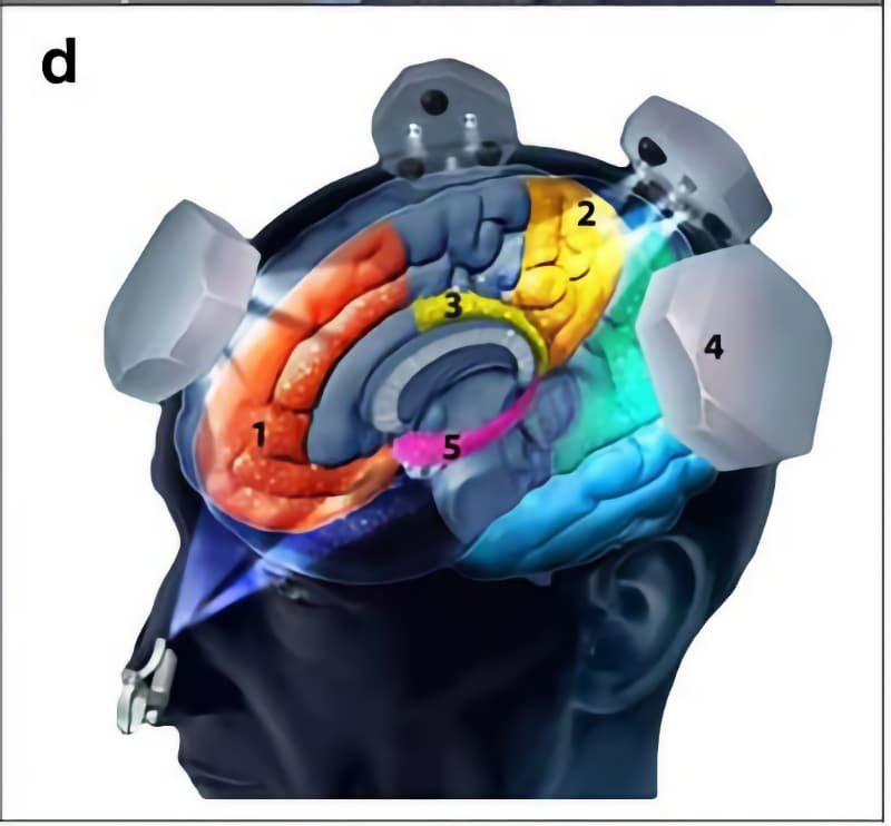 Vielight-Alzheimer-photobiomodulation