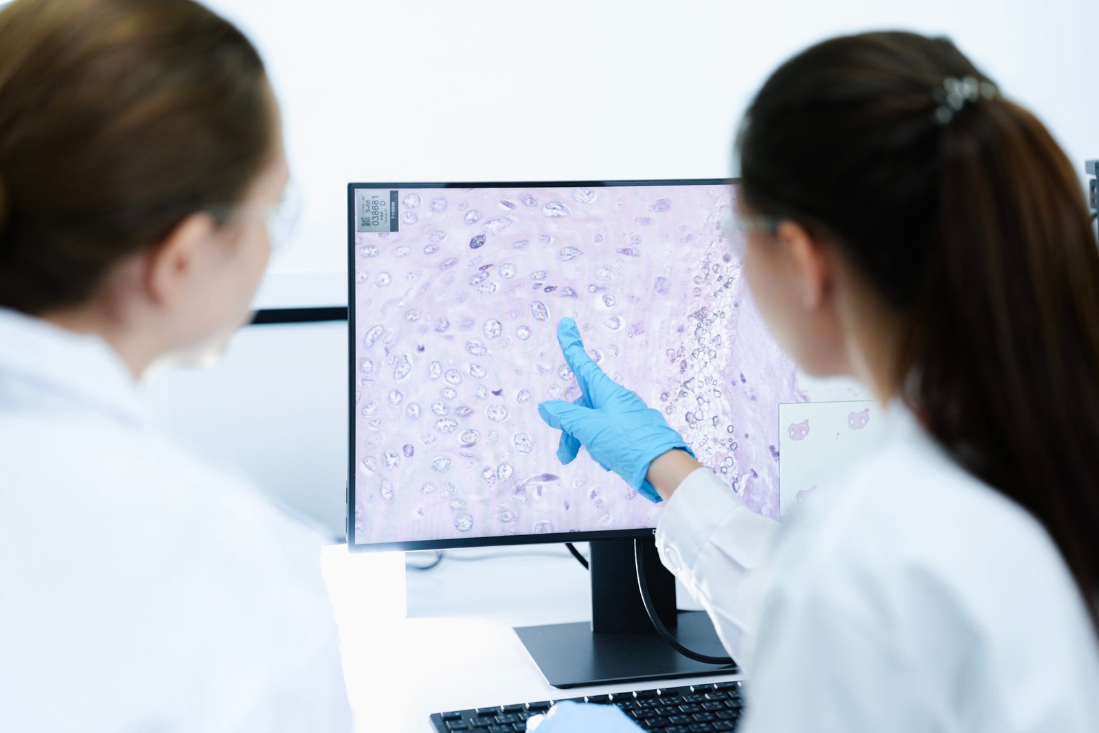 Photobiomodulation et amelioration cellulaire