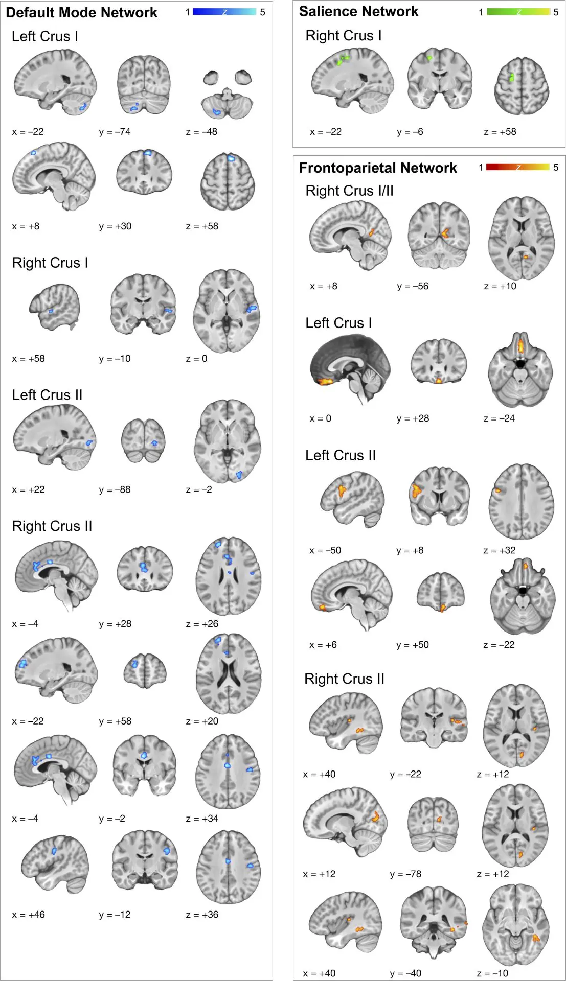 Photobiomodulation transcrânienne cervelet traumatisme crânien 