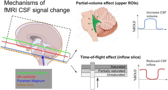 Effets de photobiomodulation intranasale sur le drainage glymphatique Effets de photobiomodulation intranasale sur le drainage glymphatique