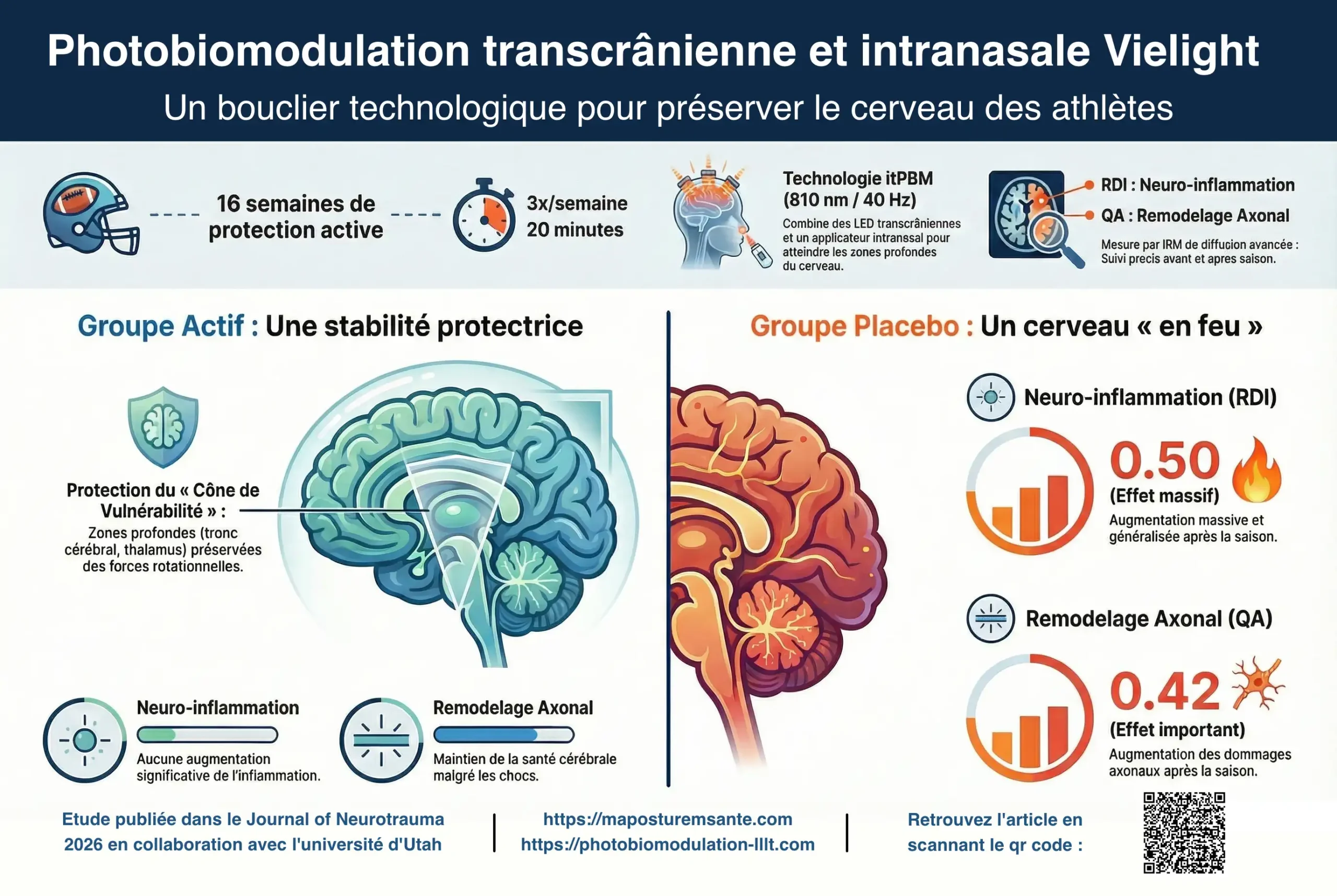 Illustration-vielight-protection-traumatisme-cranien