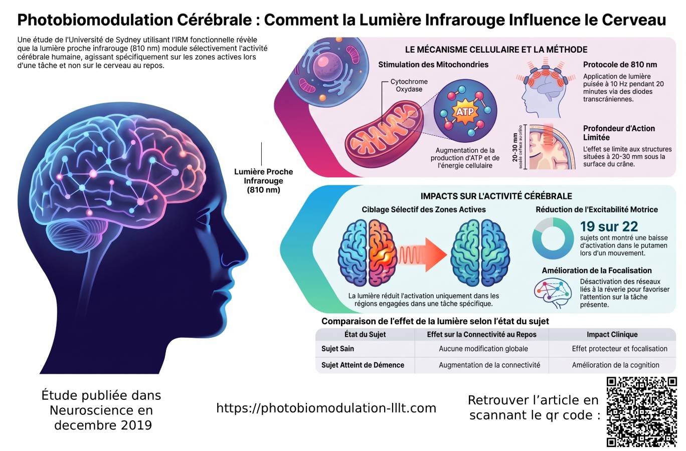 Photobiomodulation-Alzheimer-2025 - Photobiomodulation cérébrale transcrânienne lllt France Photobiomodulation-Alzheimer-2025